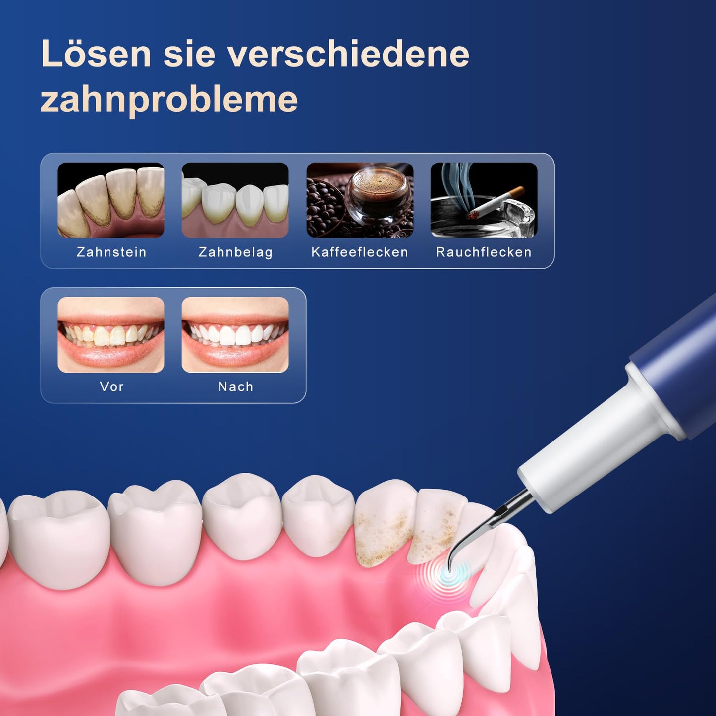 Love Begans Zahnsteinentferner Set Ultraschall Zahnreinigung